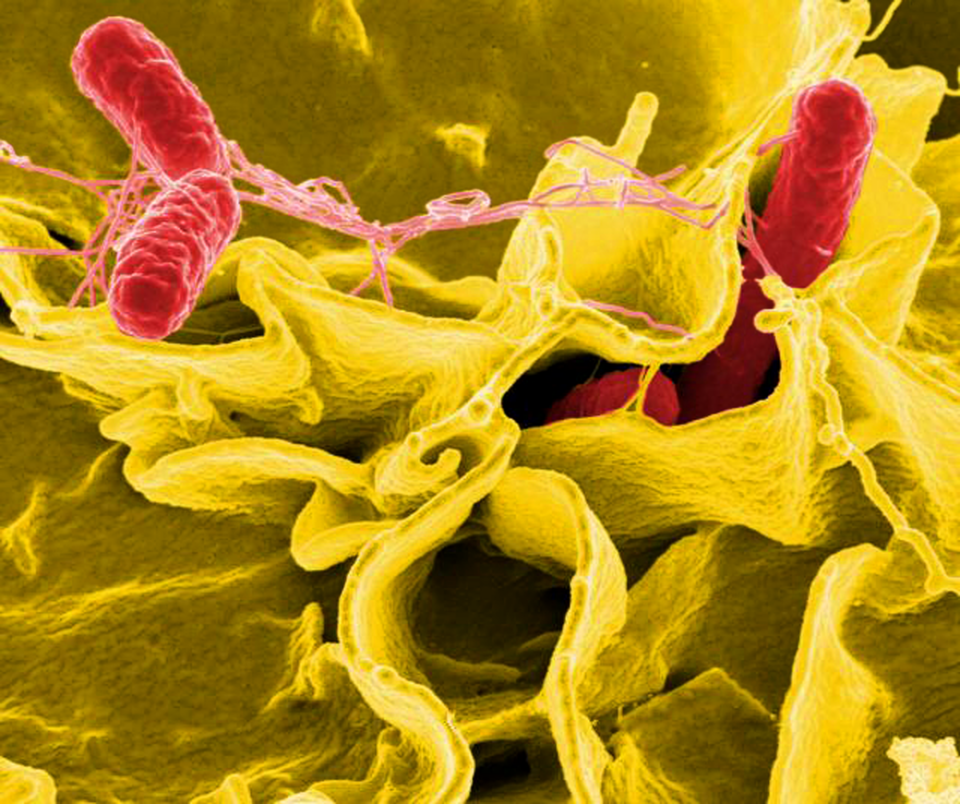 Salmonella bacteria in red and yellow