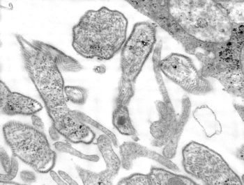 Mumps culture