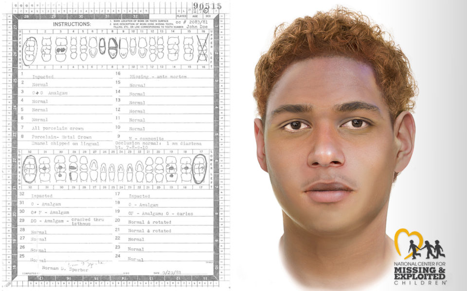 Dental record and police sketch of unidentified man