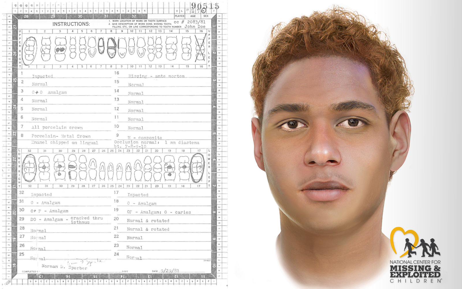 Dental record and police sketch of unidentified man