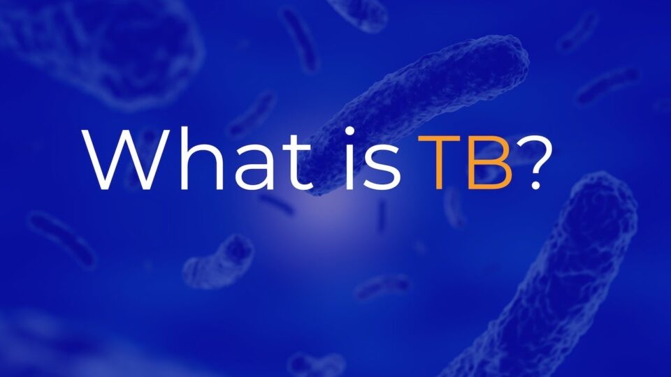 "What is TB?"