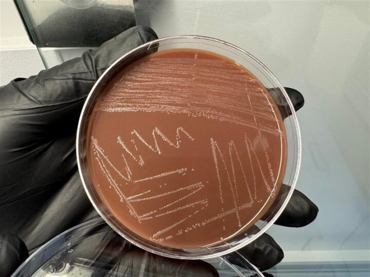 Hand holding petri dish with gonorrhea culture