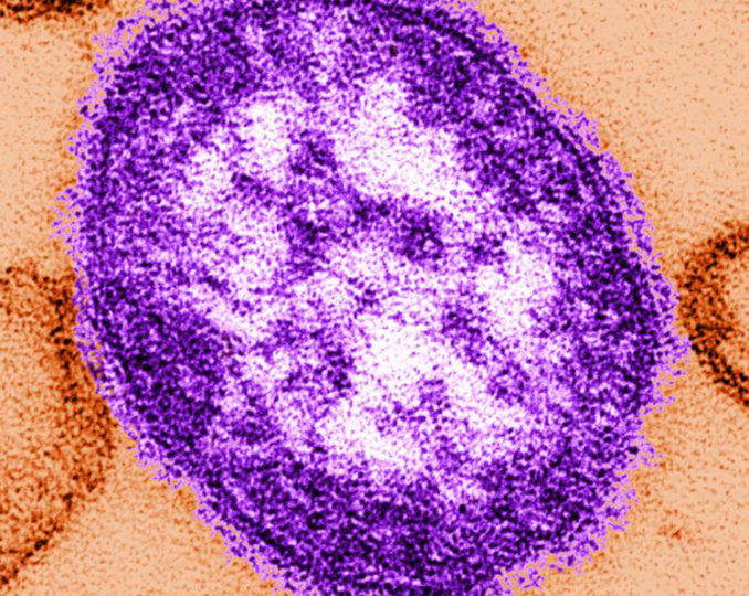 Measles virus