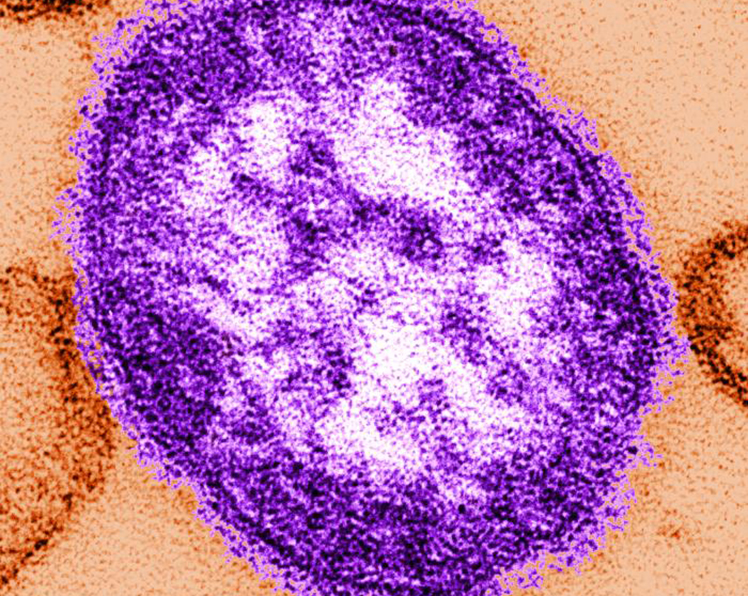 Measles virus