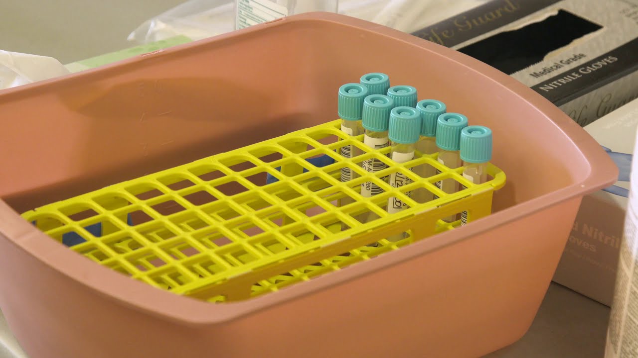 vials in a tray